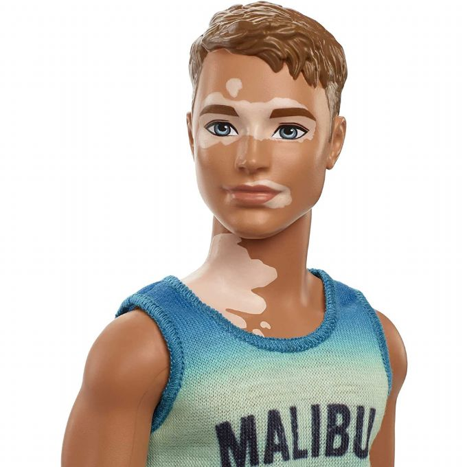 Barbie Ken Doll Vitiligo Malibu Tank version 3